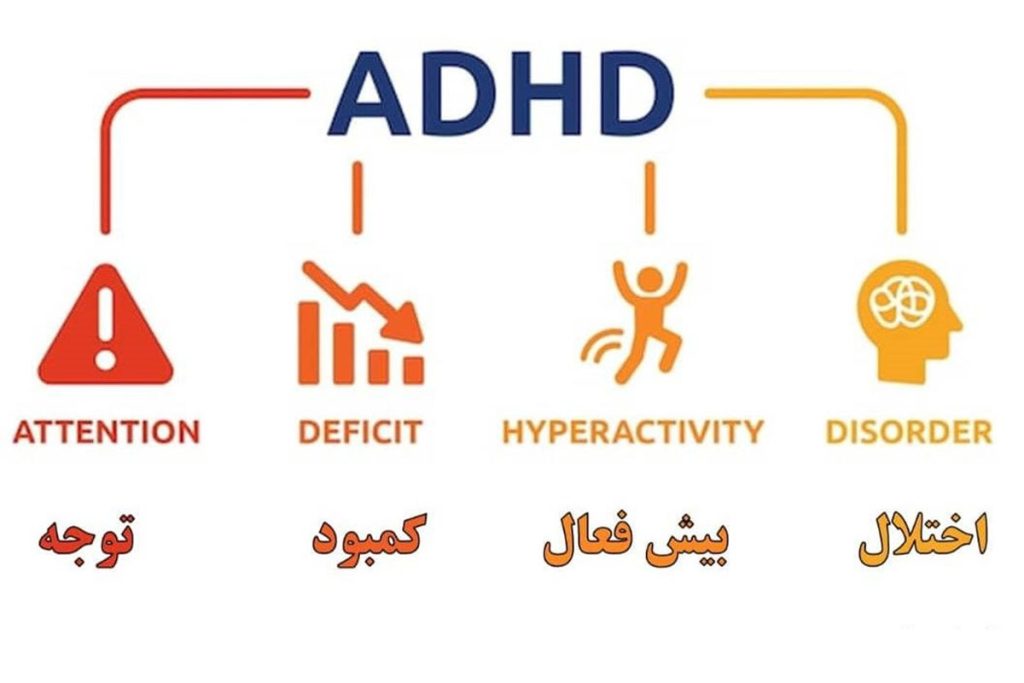 بیش فعالی